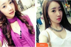 臨汾憶佳星醫(yī)療美容門診部楚向杰整形價格表附鼻部綜合案例展示