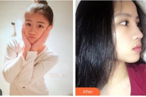 臨汾市堯都區(qū)眼科醫(yī)院樊靜住院醫(yī)師整形價格表附鼻部綜合案例展示