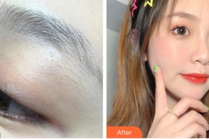 南昌美伊爾醫(yī)療美容門診部易婷婷 整形價格表附紋眉案例展示