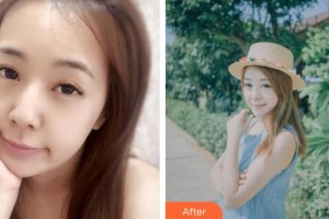 呼和浩特華醫(yī)醫(yī)療美容門診部楊定宇整形價格表附美白嫩膚案例展示