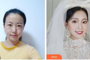 呼和浩特任榮大韓醫(yī)療美容診所張高貴整形價(jià)格表附眼部綜合案例展示