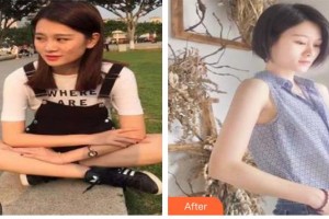 包頭麗人婦產(chǎn)醫(yī)院醫(yī)學(xué)美容科李木子整形價格表附清潔祛痘案例展示