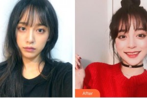 包頭伽藍(lán)（原巴諾巴奇)醫(yī)療美容醫(yī)院王林琳整形價(jià)格表附光子嫩膚例展示