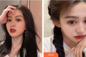 包頭麗人婦產(chǎn)醫(yī)院醫(yī)學(xué)美容科梁月月整形價(jià)格表附無針?biāo)獍咐故?>
</a>
<h3 class=