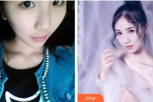 長(zhǎng)春愛麗醫(yī)療美容門診部華淑麗整形價(jià)格表附眼部綜合案例展示