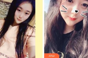 長(zhǎng)春華璦美容醫(yī)院黃慶吉整形價(jià)格表附美白劑美白牙齒案例展示