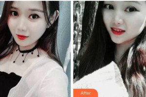 長(zhǎng)春拜博口腔醫(yī)院周文整形價(jià)格表附牙齒隱形矯正案例展示