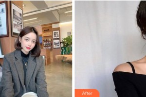 南昌愛美美容醫(yī)院玉涵整形價格表附皮膚美容案例展示