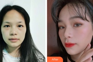 烏魯木齊新奇特醫(yī)療美容診所姜吉元整形價格表附皮膚美容案例展示