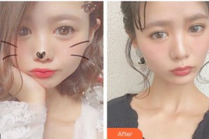 陜西省第二人民醫(yī)院眼科傅鋼整形價(jià)格表附眼部綜合案例展示