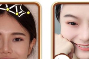 寶雞市口腔醫(yī)院毛瑩瑩整形價(jià)格表附冷光美白案例展示