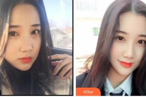 寶雞市口腔醫(yī)院任小望整形價(jià)格表附冷光美白案例展示