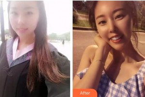 寶雞市口腔醫(yī)院王高社整形價(jià)格表附牙齒陶瓷矯正案例展示