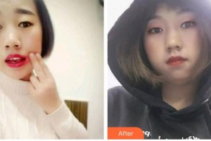 寶雞市口腔醫(yī)院姚貴良整形價(jià)格表附根管調(diào)節(jié)案例展示