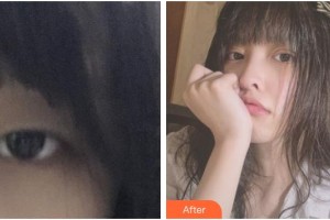 常熟瑞麗美貝爾美容醫(yī)院王大明整形價(jià)格表附眼部綜合案例展示