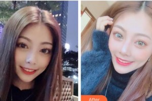 遵義利美康整形美容醫(yī)院安霞整形價(jià)格表附冷光美白案例展示