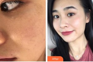 遵義韓美整形美容醫(yī)院王軍整形價(jià)格表附光子嫩膚案例展示