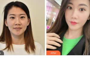 銅仁仁愛眼科醫(yī)院諶雅琦整形價格表附眼部修復(fù)案例展示