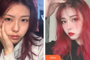 黔西南興義京州口腔醫(yī)院侯鎮(zhèn)婷整形價格表附美白貼片案例展示