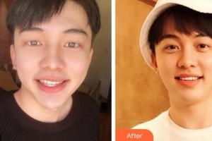 黔西南牙管家口腔醫(yī)院徐泓整形價格表附美白貼片案例展示