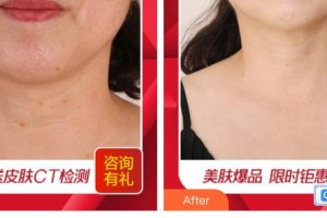 廣西東方整形美容醫(yī)院徐國建整形價格表附祛疤痕案例展示