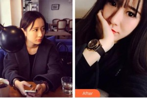 柳州愛爾眼科醫(yī)院陳光勝整形價格表附定點雙眼皮案例展示