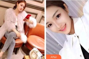 柳州紅十字會眼科醫(yī)院黃紅波整形價格表附切開雙眼皮案例展示