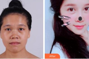 貴港愛爾眼科醫(yī)院馮桂強(qiáng)整形價(jià)格表附眼部修復(fù)案例展示