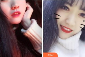 江陰牙博士口腔門診部蔡正飛整形價格表附美白劑美白牙齒案例展示