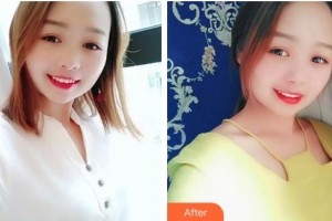 江陰牙博士口腔門診部桂禮朋整形價格表附活性牙模美白案例展示