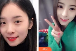 海南省中醫(yī)院眼科中心趙仲平整形價(jià)格表附眼部綜合案例展示