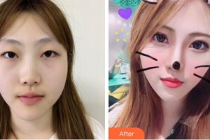 海南省中醫(yī)院眼科中心何瓊敏住院醫(yī)師整形價(jià)格表附眼部綜合案例展示