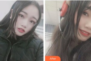 海口杭牙維信口腔門診部方略宇整形價格表附牙齒隱形矯正案例展示