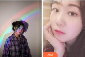 ?？诤佳谰S信口腔門診部曾婷整形價格表附超聲波潔牙案例展示