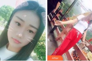 ?？谕？谇婚T診部陳新整形價格表附美白貼片案例展示