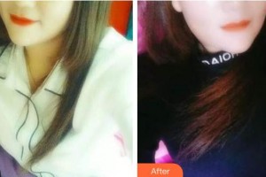 ?？隈R華祥口腔門診部馬華祥整形價格表附牙齒隱形矯正案例展示