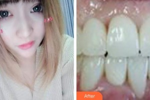 ?？诘露骺谇婚T診部喬磊整形價格表附超聲波潔牙案例展示