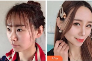 ?？诩t妝尚醫(yī)療美容門診部吳健整形價格表附眼部綜合案例展示