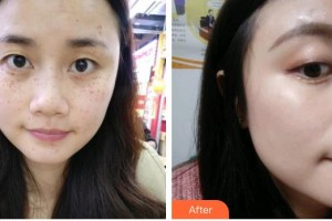 海口紅妝尚醫(yī)療美容門診部姚志文整形價格表附激光美膚激光案例展示