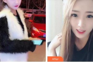 揚(yáng)州貝恩口腔醫(yī)院張必安整形價(jià)格表附牙齒隱形矯正案例展示