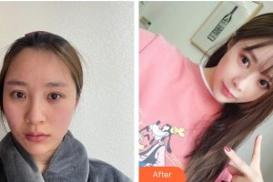 荊州市中心醫(yī)院整形美容外科董潔整形價格表附激光祛疤案例展示