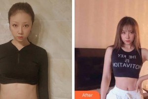 荊州美傲醫(yī)療美容診所徐國健整形價格表附微創(chuàng)疤痕修復(fù)案例展示