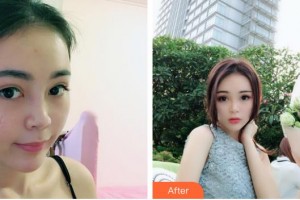 荊州市第二人民醫(yī)院整形激光美容中心雷濬嶸整形價格表附激光祛疤案例展示