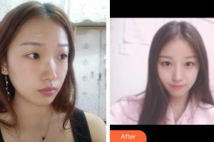 荊州名韓醫(yī)療美容診所李萍整形價格表附手術(shù)祛疤案例展示