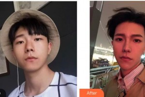 荊州市婦幼保健院眼科韓敏杰整形價(jià)格表附眼部綜合案例展示