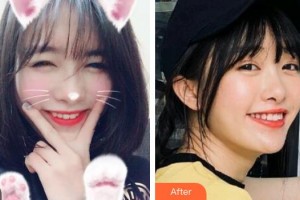 荊州公安縣楚星口腔門(mén)診黎燕整形價(jià)格表附冷光美白案例展示