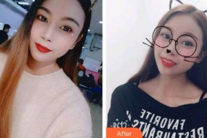 黃岡皓雅口腔醫(yī)院王丹整形價格表附牙貼面案例展示