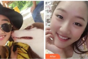 黃岡皓雅口腔醫(yī)院何秀坤整形價格表附牙齒隱形矯正案例展示