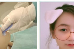 孝感君雅口腔門(mén)診劉心整形價(jià)格表附隱形托槽矯正案例展示