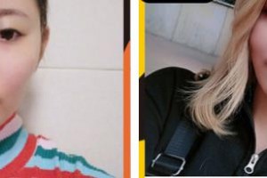 鄂州愛(ài)爾眼科醫(yī)院林思勇整形價(jià)格表附眼部綜合案例展示